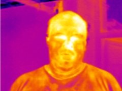 Wenn kein Schmerzmittel mehr hilft